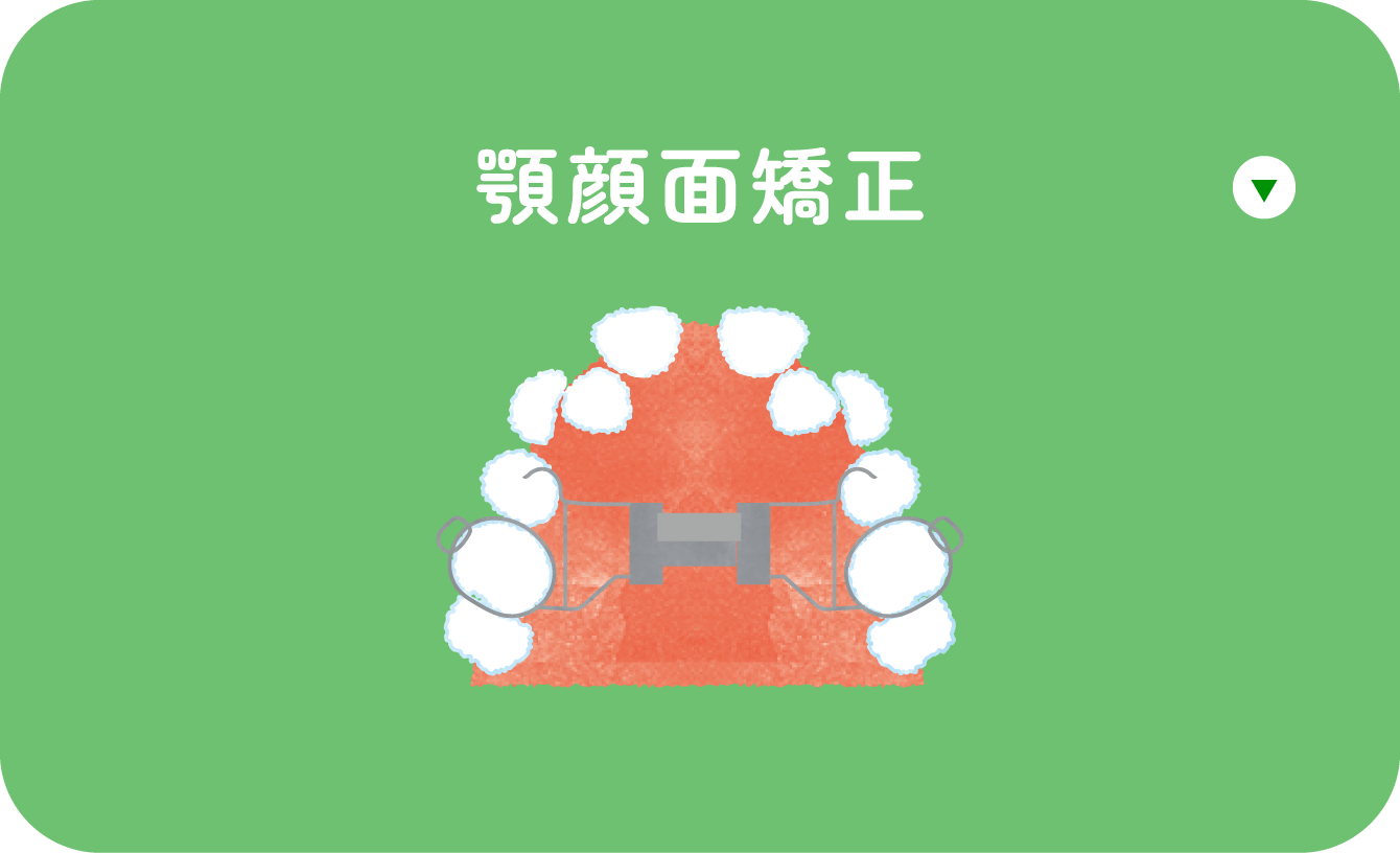 顎顔面矯正