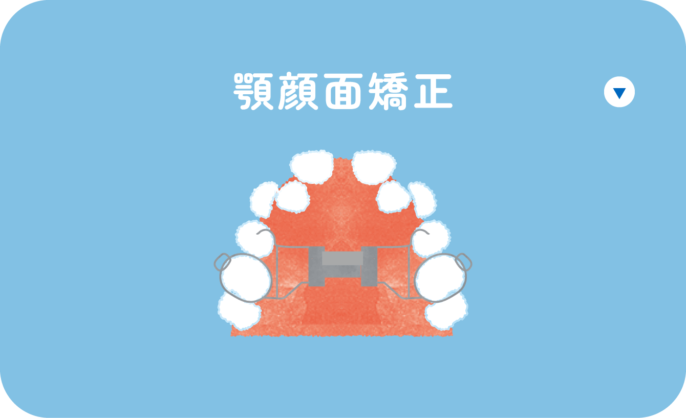 顎顔面矯正
