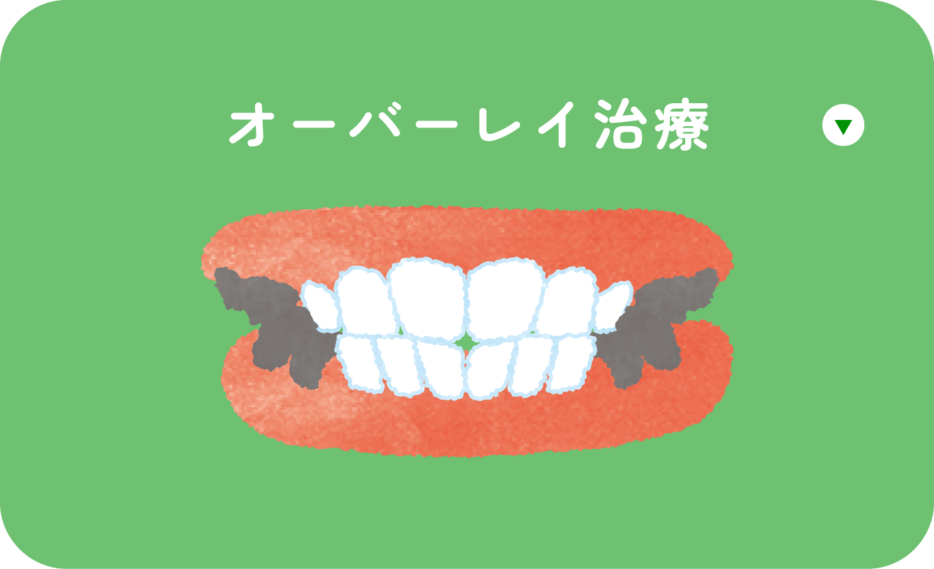 オーバーレイ治療